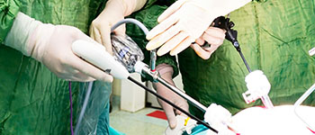 laparoscopic surgery KANPUR